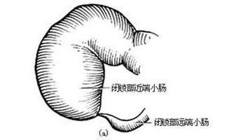 肠袢是什么意思 360搜索