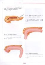 胰腺外科学图解_360百科