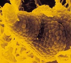 弗兰克氏菌属_360百科