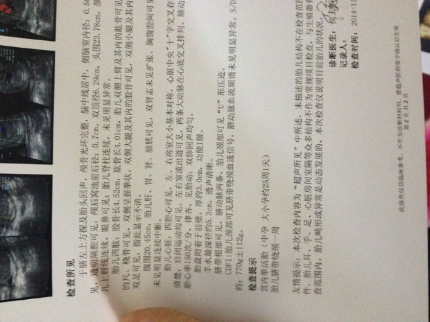 大家觉得是<em>女宝</em>还是男宝啊,有经验的宝妈们_3