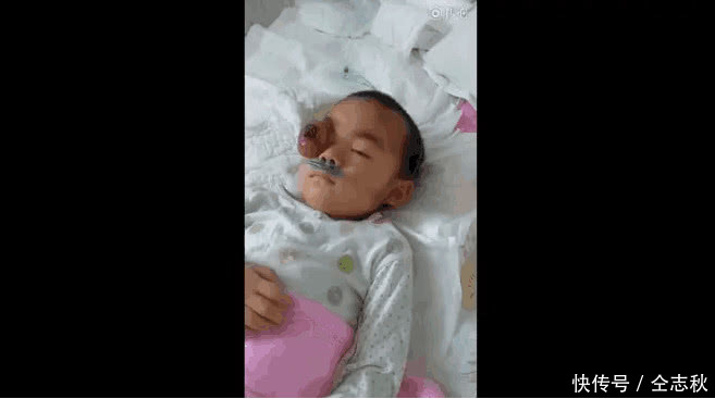 3岁女童死亡, 医院回应:钱没用来治愈哥哥的兔唇