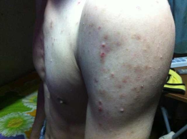 什么病会使皮肤变黄变黑 t010da9fd0d2f6890b5.jpg