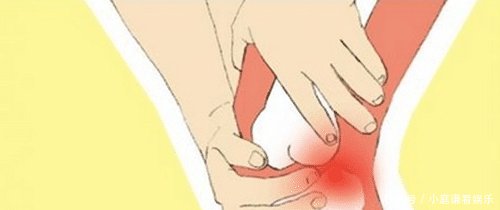 膝关节上下楼梯都会痛是什么原因