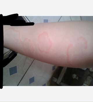 50岁了还能出花吗