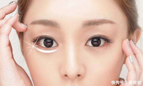 孩子越来越大，你的眼袋越来越重，看她怎么去除眼袋!