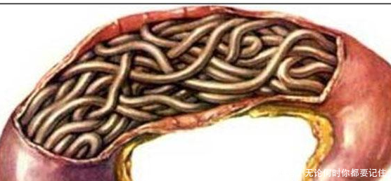 6岁女童饭前总闹肚子疼,吃完胃药也没用,医生