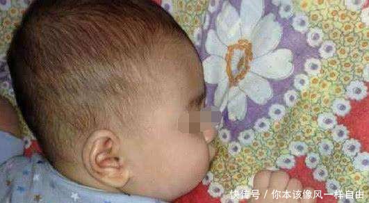 1岁宝宝感染疱疹病毒患上脑膜炎,不幸离世,家