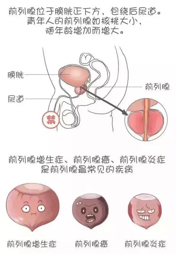 前列腺的小秘密,档案的小秘密你都知道吗?