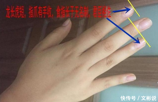 小拇指有“此”特征的人,必是富贵双全
