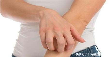 皮肤过敏是否有必要做过敏源测试?答案可能和