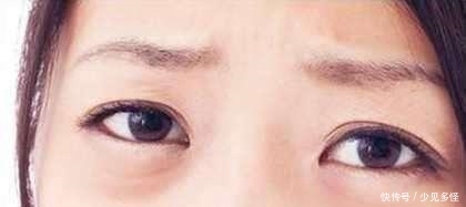 全球热销800万瓶的“眼霜”,因包装太土无人理,网友:错过十几年 诚博娱乐注册