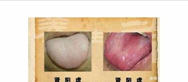 你是肾阳虚还是肾阴虚, 老中医教你如何区分