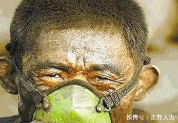 用人单位可以与疑似职业病的员工解除劳动合同