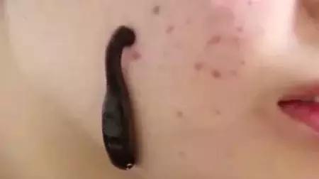 美女将水蛭放在脸上让它吸血,20秒之后她笑的合不拢嘴