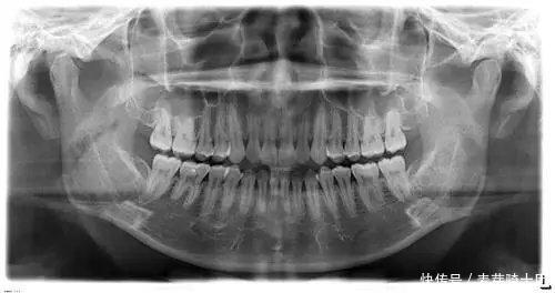t015ffed78971feffa8.jpg