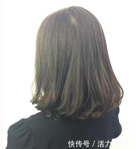 总洗头发,头皮屑还很多又很痒,医生:很可能跟这