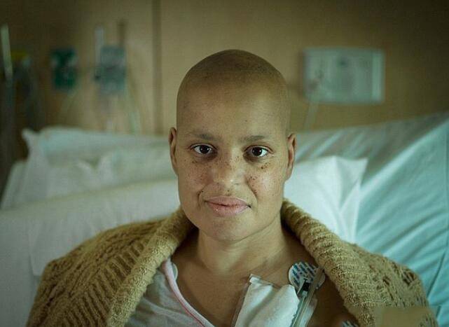 图为一位癌症患者,化疗让她的头发掉得精光,微微露出的苦笑,表明她的