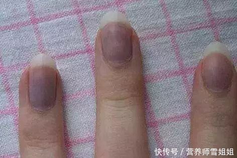 女人肝不好,身体这3处可能会发黑,切莫忽视!