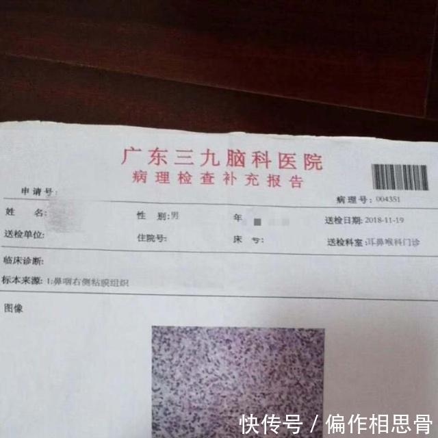 体检报告称鼻窦炎,半年后确诊鼻咽癌中晚期患