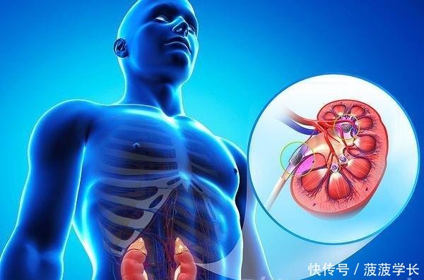 女子腰疼去医院,男医生在她右肾取出2980颗硬