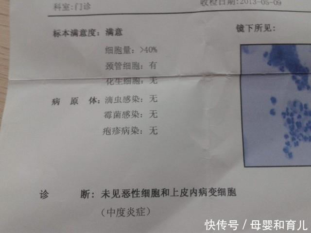 备孕期做妇科检查,发现宫颈糜烂医生却说不用