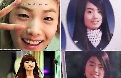 韩国整容最成功的6位女星刘仁娜第3,朴敏英第