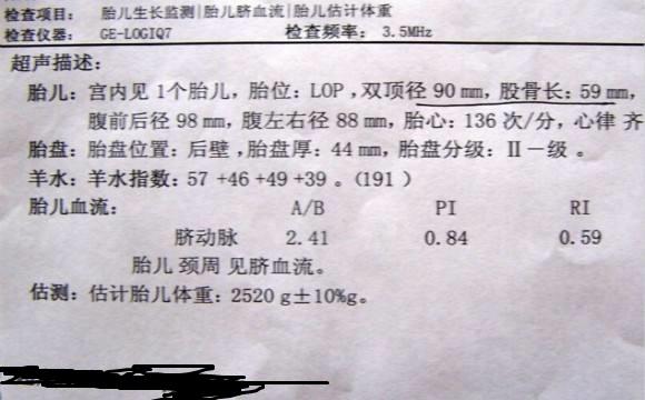 试管二胎男孩一枚,终于凑成一个好字,说说我的