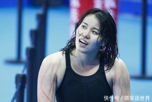 满臂抓痕! 傅园慧自虐式激励 不会留疤爸妈会说