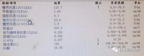 这里有一例集少见情况于一身的「亚联」