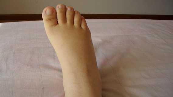 女人肾不好,身体会出现这3个变化,多吃这6种食