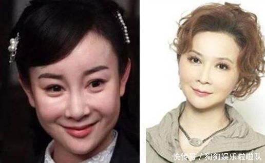整容失败,整容失败案例图片