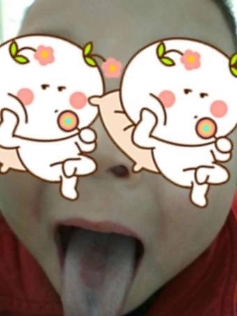 便秘10个月案例,一代宗师健脾贴让孩子重新拉