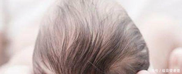 宝宝的头顶上有个坑出现了这4种状况,赶紧送