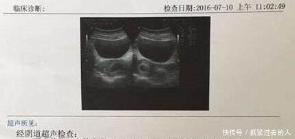 怀孕后B超单透露的重要信息!教你看懂9大关键