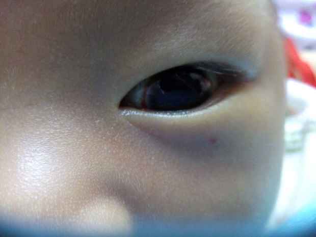 婴儿黑眼珠有油花大全_婴儿黑眼珠有油花图集