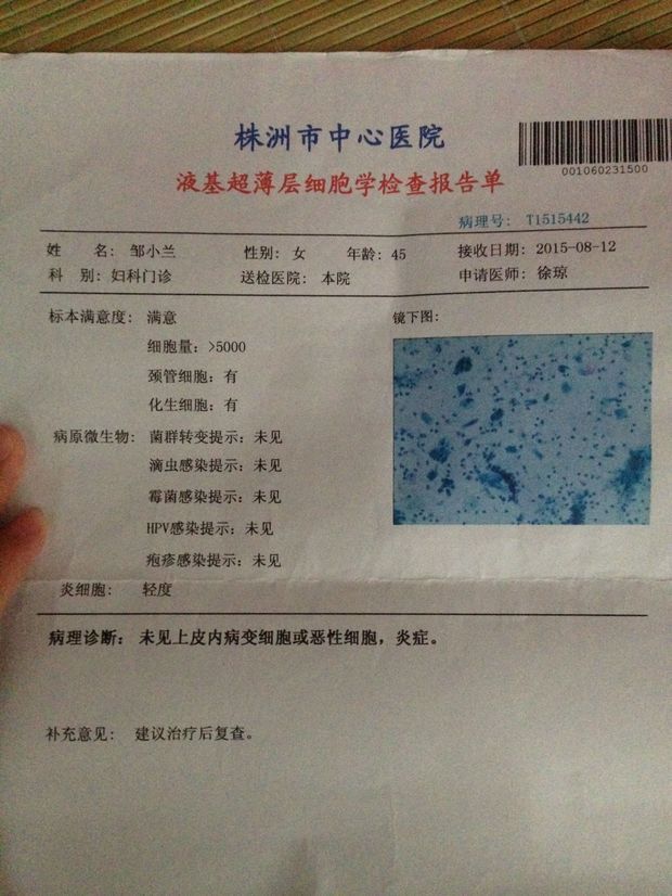 tct检测正常hpv高危阳性严重吗