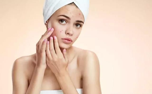 背上、胸口爱长痘痘是怎么回事?