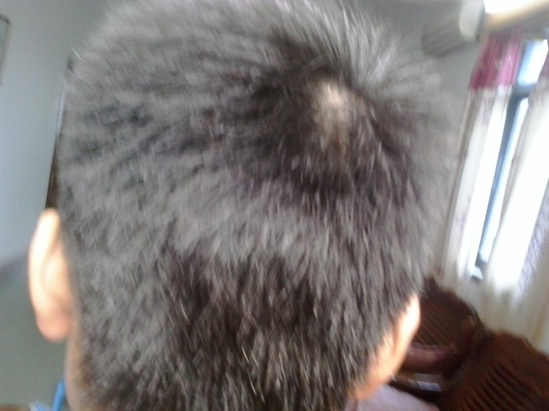 请问这种干燥而且竖起来的头发除了<em>剪平头</em>,还