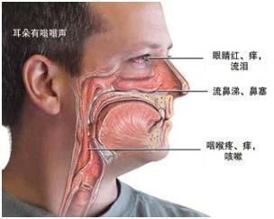 刘玉梅: 鼻咽炎头痛发生在什么部位