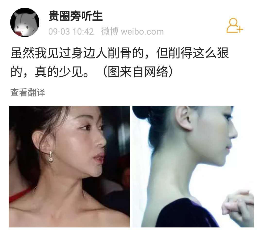 卫龙cp双双削骨？网友质疑吴谨言整容，下巴快要戳死自己！