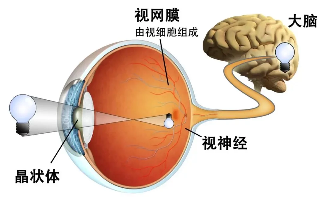 為什麼我摘下眼鏡，就聽不清别人說話了？