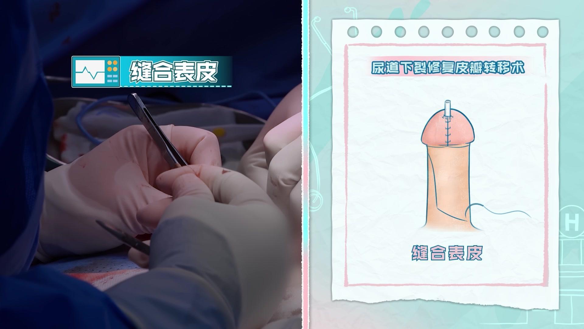 你好，儿科医生第三季 你好，儿科医生第三季 第17集