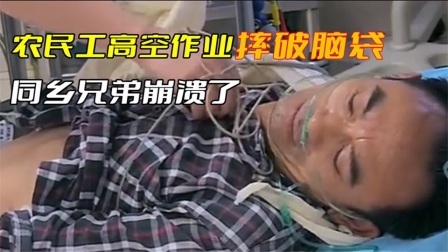 农民工从高空坠落摔破脑袋，医生千辛万苦的抢救
