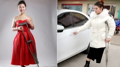 涨健识 单腿美女开启励志新生活