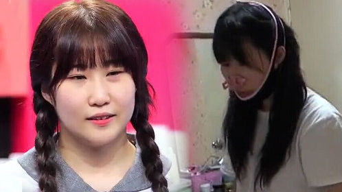 Oh My思密达 第164期：韩女中学生沉迷整容亲自动手