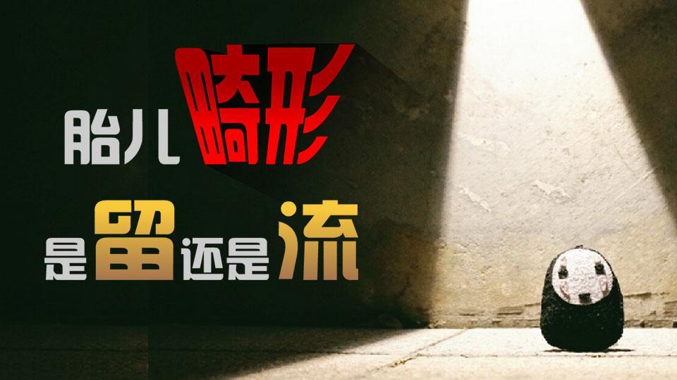 全民宝贝计划第五季 胎儿畸形，是“留”还是“流”？