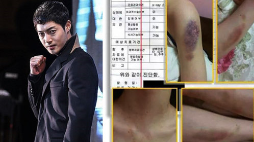 Oh My思密达 第151期：韩星疑暴打女友致流产被封杀