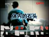 健康之路 《健康之路》 20110906 胆结石之惑