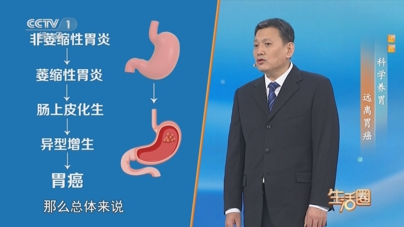 生活圈 《生活圈》 20250711 科学养胃 远离胃癌