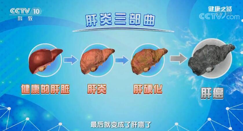健康之路 《健康之路》 20190612 莫把炎症变癌症（下）